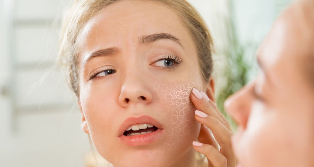 Dry and Sensitive Skin
