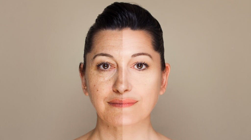 How To Reduce Wrinkles and Achieve Glowing Skin?