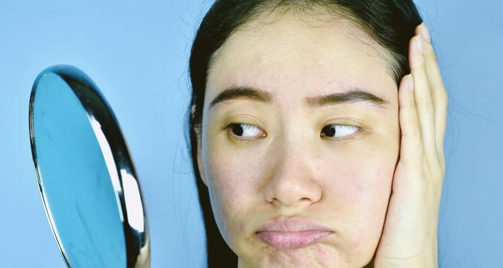 women experiencing skin dullness