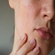 Dull Skin Collection