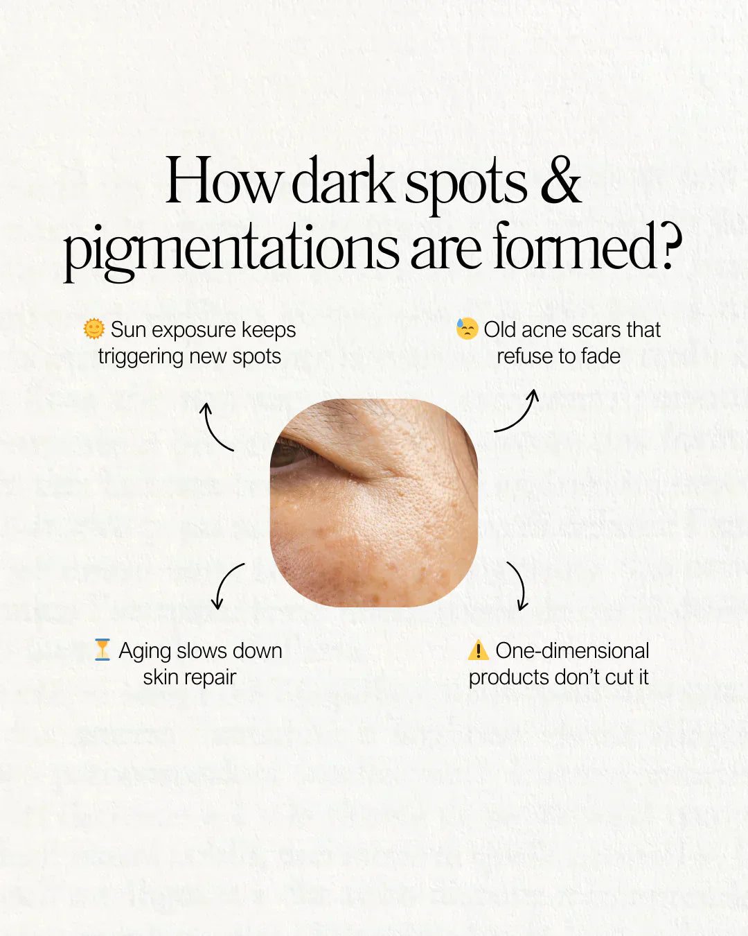 Still battling stubborn dark spots and pigmentation?