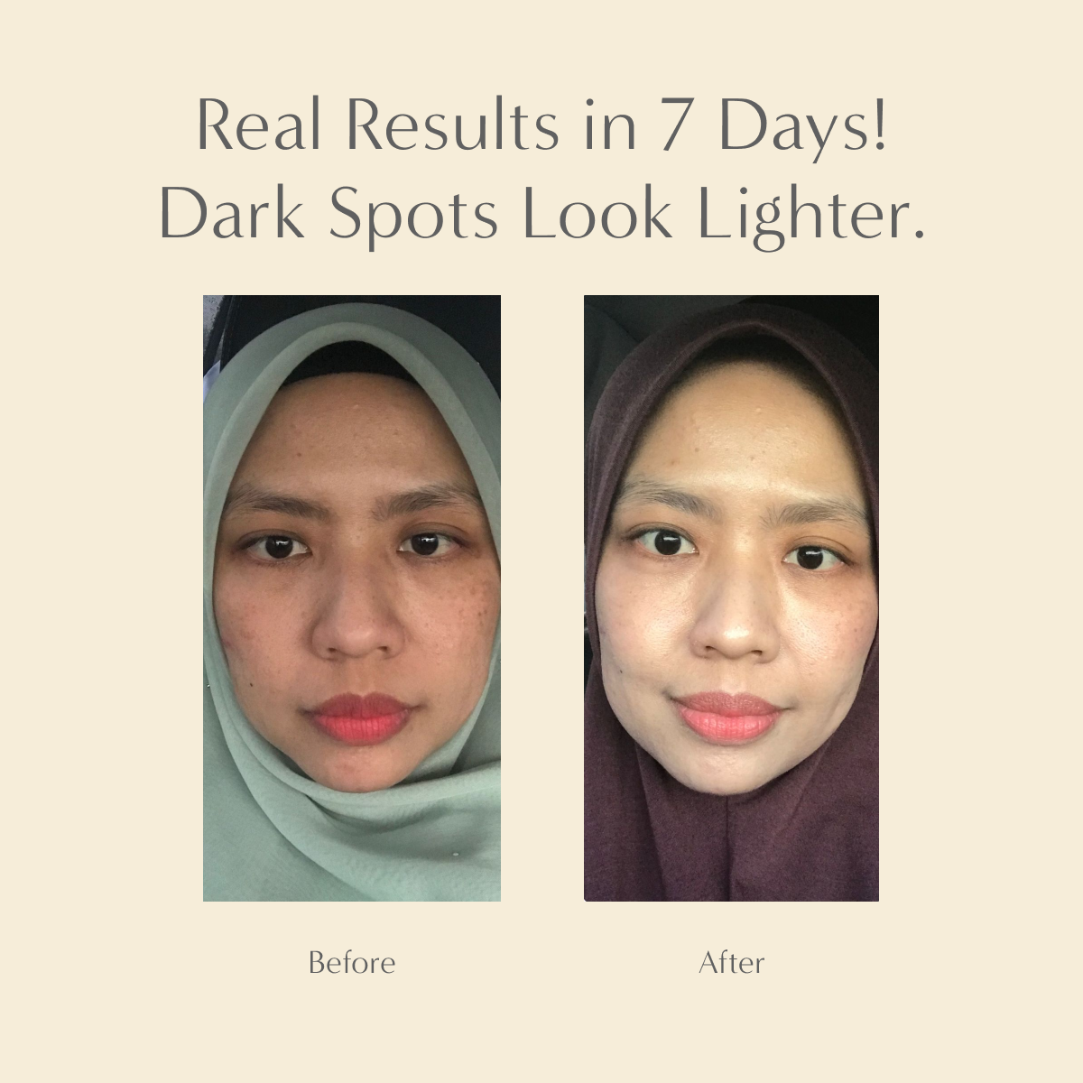 Gold Radiance Serum