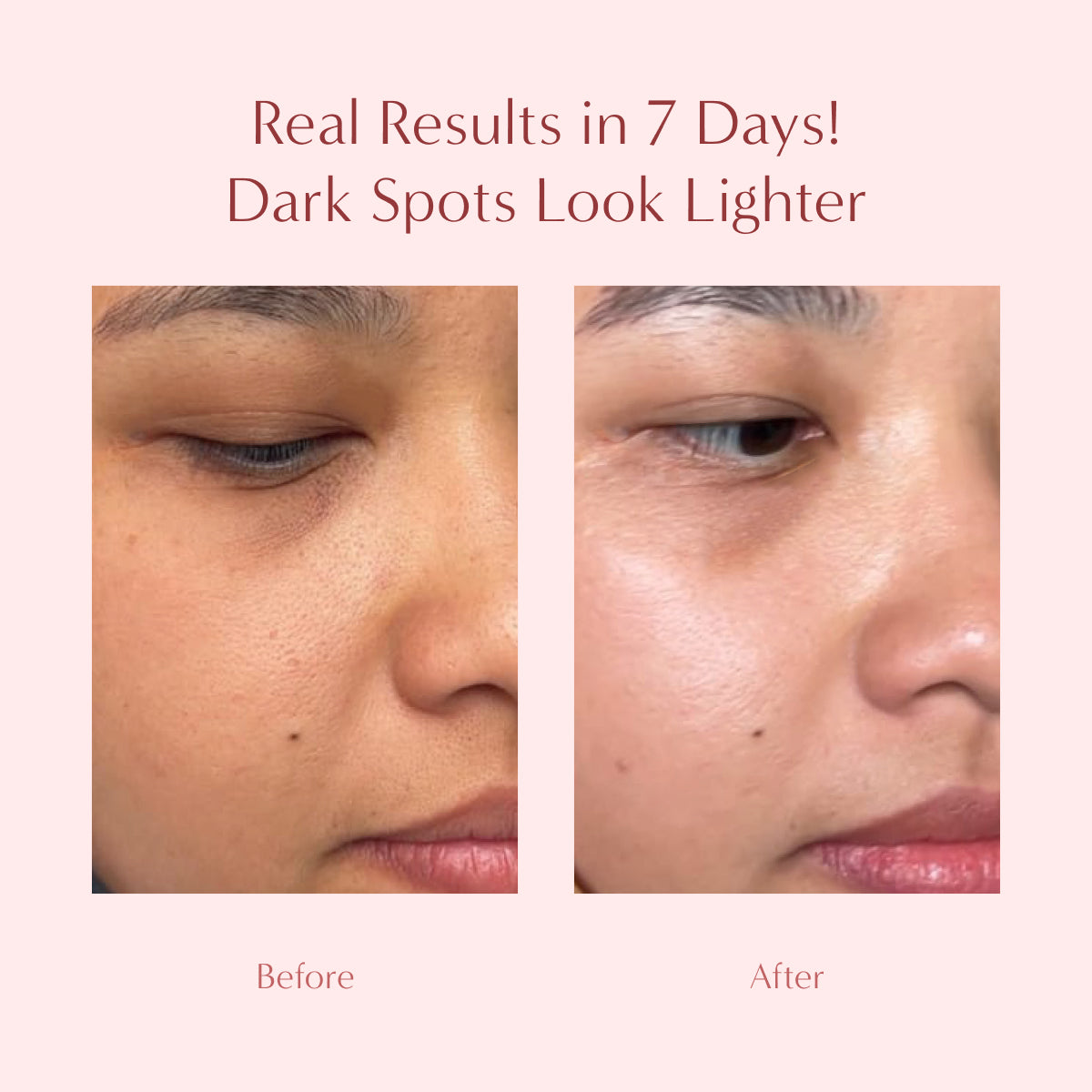 Radiance: Gold Radiance Serum [Limited Edition]