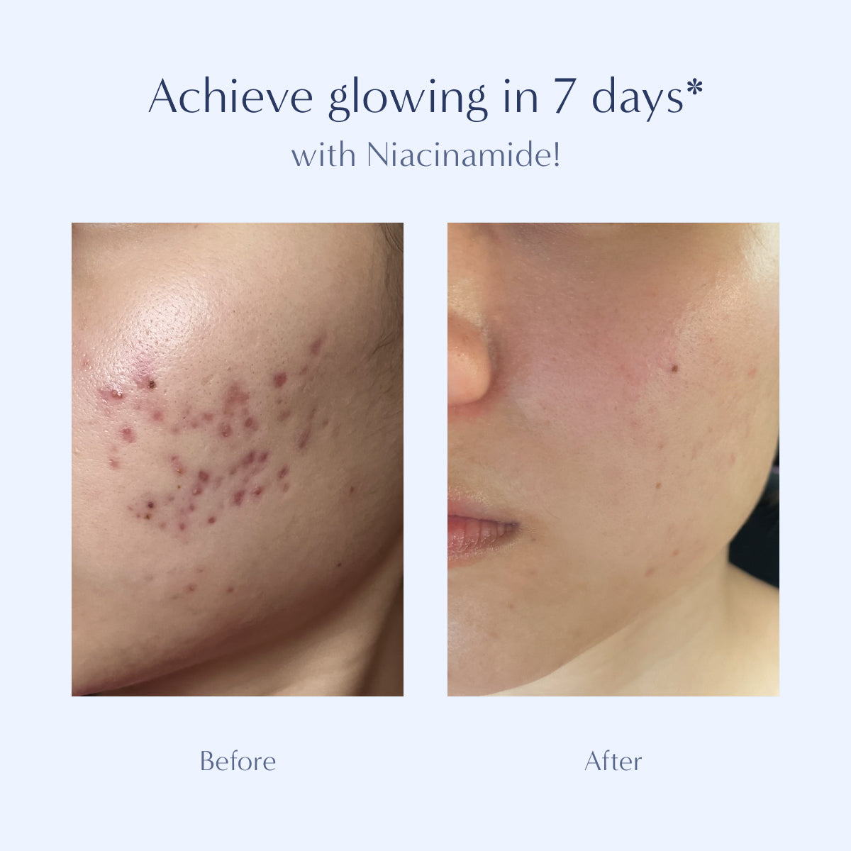 Renewal: Triple Action Serum [Limited Edition]