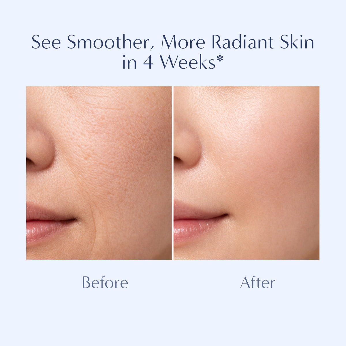 Renewal: Triple Action Serum [Limited Edition]